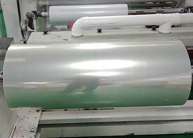 Printing Screen Thermal Transfer Film For Colour Doppler Ultrasound / CT Results